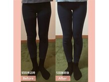 フェルナ(FERNA)の雰囲気（Before/Afterはフォトギャラリーをご覧ください。）