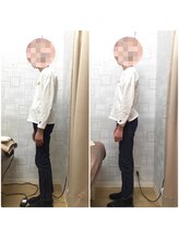 日本橋八重洲整体院/姿勢改善【Before→After】