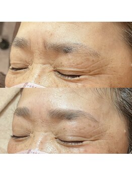 ベレーザ(Beleza.)/ハリウッドブロウリフト