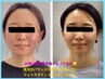 【小顔】むくみ顔たるみケア/ほうれい線撃退&スッキリ小顔！コース初回体験