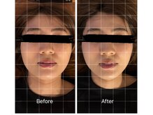 リアルボイス(REAL VOICE)/食いしばりの原因を撃退