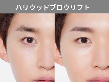 アポロ(Apollo)/ハリウッドブロウリフト