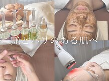 ミーツ(Meets)の雰囲気（毛穴、ニキビ、くすみ、シミ、しわ…お肌悩みお聞かせください）