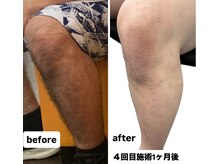 量も少なく、毛も細くなってきてます♪