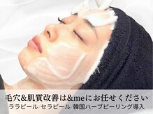 今話題ララピール◎【ハーブピーリング/ニキビケア/毛穴洗浄】