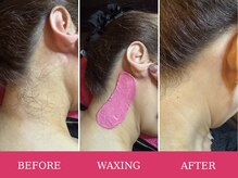 マロズワックス ブラジリアンワックスアンドスパ(Maro's Wax Brazilianwax Spa)/うなじWax★Before After