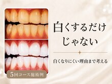 ペルラメディカルホワイトニング 名古屋