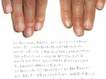 リング ザ ベル(ring the bell)/深爪・育爪専門コース