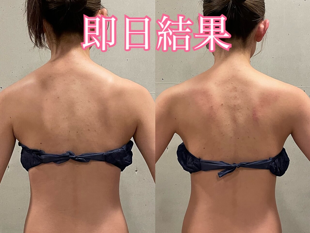 簡単ダイエット無刺激★高周波温熱美肌献身美容器★ビューティワールドお求めの方にも 簡単ダイエット無刺激☆高周波温熱美肌献身美容器☆ビューティワールド