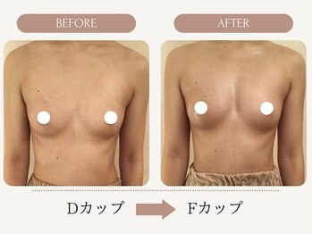ウェルバスト(Well Bust)/【バストアップ例】D→Fカップ