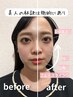 【小顔矯正+美容整体】小顔と美姿勢が叶う★¥6980/90分（検査込み）