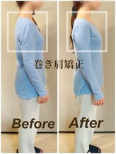 ティーエスエル とがし整体ラボ(TSL とがし整体 Labo)/小顔矯正・骨盤矯正・反り腰