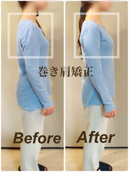 ティーエスエル とがし整体ラボ(TSL とがし整体 Labo)/小顔矯正・骨盤矯正・反り腰