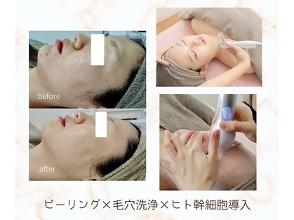 ビーユー(Be.you)の写真