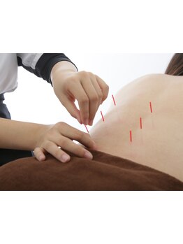 鍼灸施術を受けたい