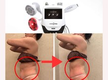 ドルチェエフェクト(dolce effect)/セルゼロ２