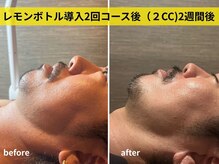 アマンビューティーリゾートの雰囲気(メンズにもおすすめレモンボトルエステ!短期間で若見え◎)