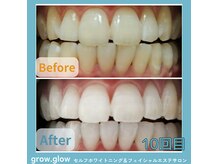 グロウ グロウ(grow.glow)の雰囲気(丁寧なカウセリングが人気◎歯質に合わせたオーダージェルで白く)