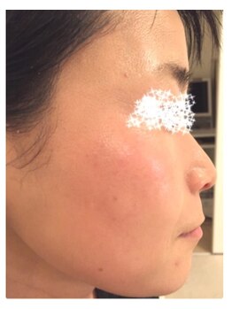 セレスティア(Cellestia)/