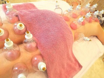 カリタス(CARITAS Total Beauty Esthetic Salon)/プハン（吸い玉）