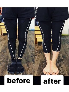 カワル整体 上通り院/【O脚矯正】