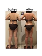 ラヴィニティ 北千住店(Lavinity)/北千住の痩身といえば！