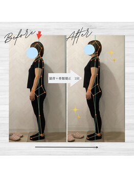 ラクリエ 東加古川院(La Creer)/お客様ビフォーアフター