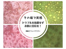 ベベ 大阪中央店(Be’be’)の雰囲気（施術前後にカメラで撮影してお肌の変化をしっかり診断します♪）