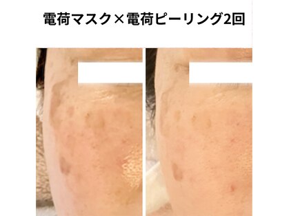 トッコボディケアの写真