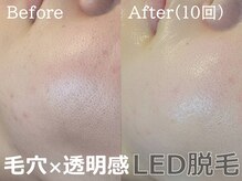 ルナステラ 金沢店の雰囲気（LED美顔脱毛/毛穴/くすみ一掃/ハリ・ツヤ・透明感UP/脱毛/顔脱毛）