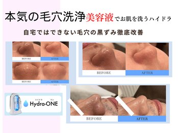 フルールスレーヌ(Fleur Sereine)の写真/お肌の奥に詰まった汚れをごっそり洗浄！透明感溢れるお肌へ導き、同時にリフトアップも叶います◎