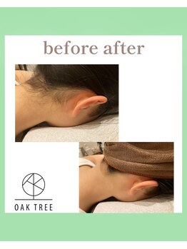 オークツリー(oak tree)/Before After