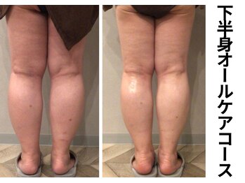 プラマイル(Pramile)/下半身オールケアコース