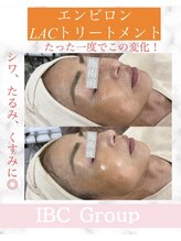 トータルサロンアイビーシー(トータルサロンIBC)/エンビロンで美白、美肌に