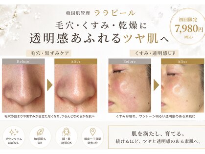 あすはれの写真