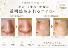 あすはれ