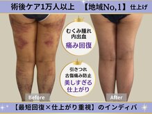インディバ痩身サロン プルミエ(premier)
