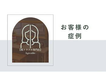 アーブル(Agreable)/肌は変わります