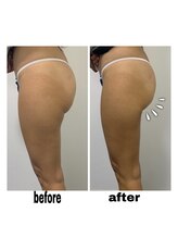 エクスクラメーションマーク(!!!)/ボディー