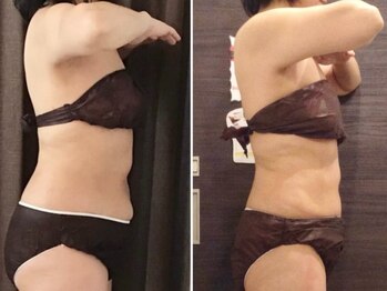 美容整体 ウェリナ 蟹江院/小顔矯正/骨盤矯正/美脚サロン