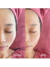 エムスパサロン マモ(Mspa salon mamo)/くすみ、小じわにお悩みの方に