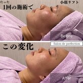 サロン ド パーフェクション(Salon de Perfection)