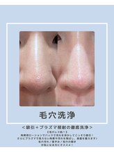 ソワナ(soina)/【神楽坂駅/フェイシャル/毛穴】