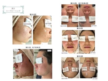 ベルスタイル(Bell style)/当店のお客様症例(ハーブ)