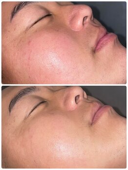 ホワイトニングビューティー 金沢駅前店(WHITENING BEAUTY)/細胞を活性化して元気な肌へ