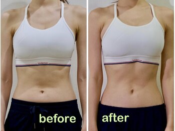 アズール(azure)/お腹周り、スッキリコース