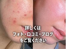 マリヴェリーテ(Mari verite)の雰囲気（丁寧なカウンセリング。お悩み、症状をお聞かせください。）