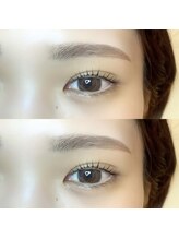 リンネ(LinNe)/KURUMI担当