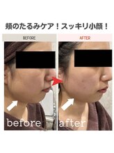 ビーフィール 府中店(be feel)/フェイスラインもスッキリ