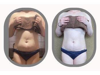 ルナルナ(RUNA RUNA)/ビフォー、アフター